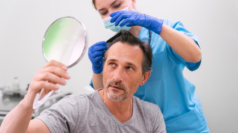 Quels résultats peut-on attendre d’une greffe de cheveux ?